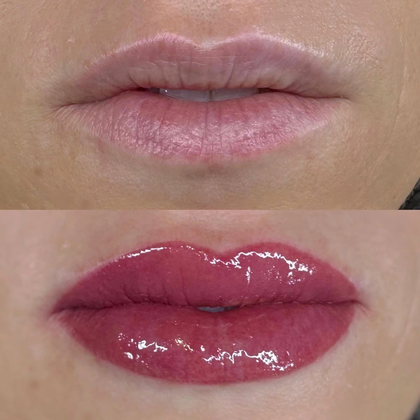lip2