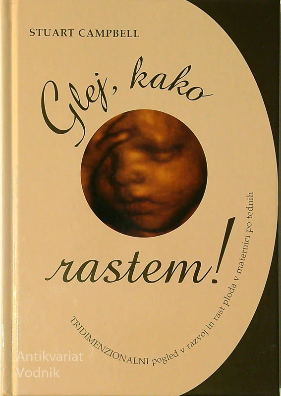 GLEJ, KAKO RASTEM!, Stuart Campbell
