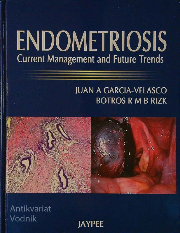 ENDOMITRIOSIS; CURRENT MANAGEMENT AND FUTURE TRENDS