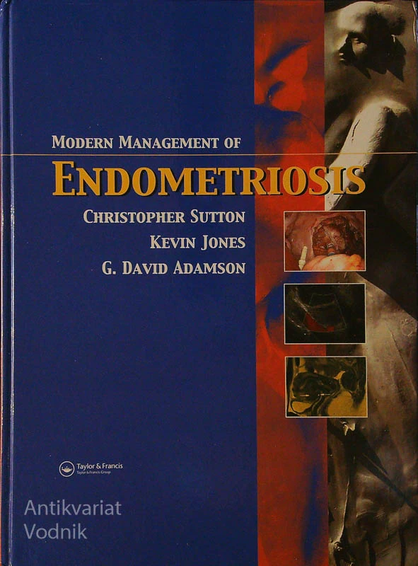 MODERN MANAGEMENT OF ENDOMETRIOSIS