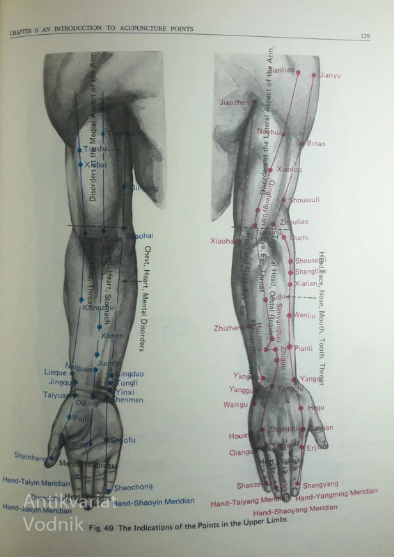CHINESE ACUPUNCTURE AND MOXIBUSTION, uredil Cheng Xinnong