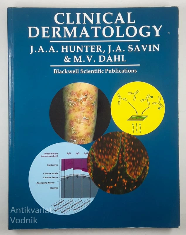 CLINICAL DERMATOLOGY, Hunter, Savin & Dahl