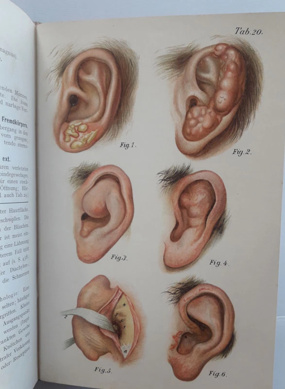 Učbenik ušesne medicine: OHRENHEILKUNDE von Bruehl