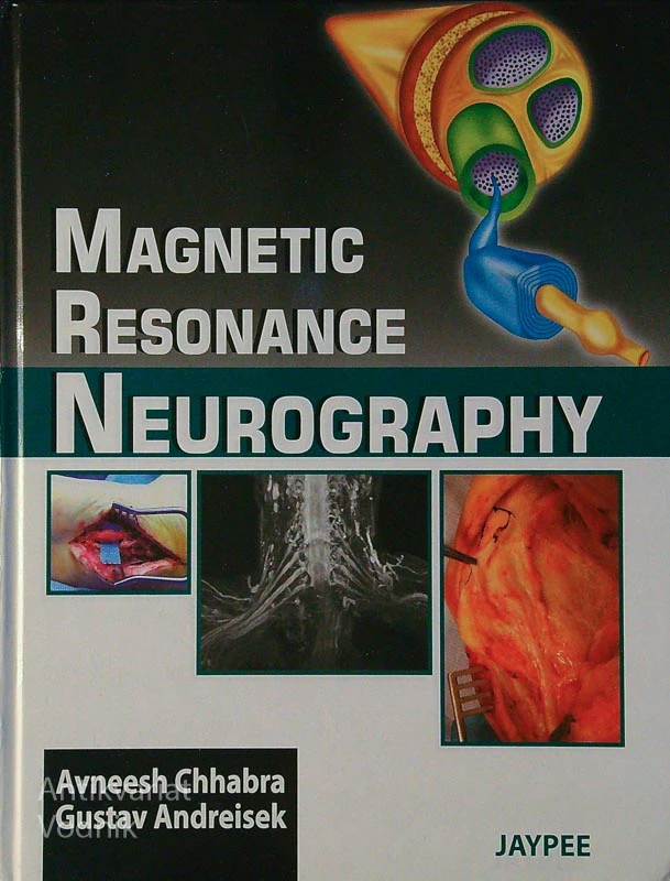MAGNETIC RESONANCE; NEUROGRAPHY, Awneesh Chhabra in Gustav Andreisek