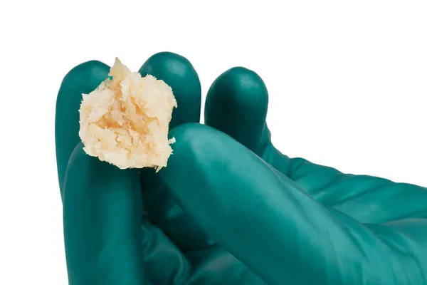 DBM Putty (Demineralized Bone Matrix)