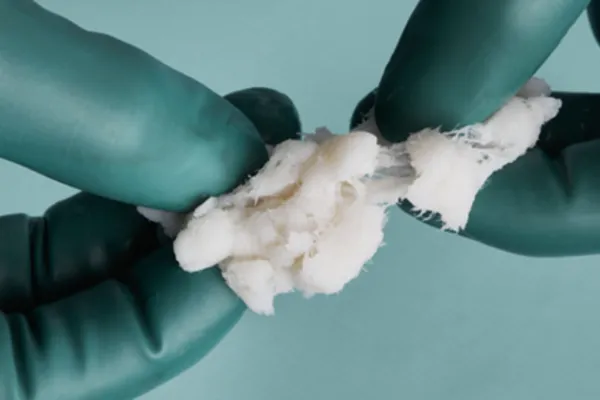 Ligaments, Putties, Menisci, Cartilage