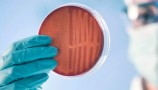 MRSA - davek na »razvoj«?