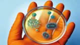MRSA - davek na »razvoj«?